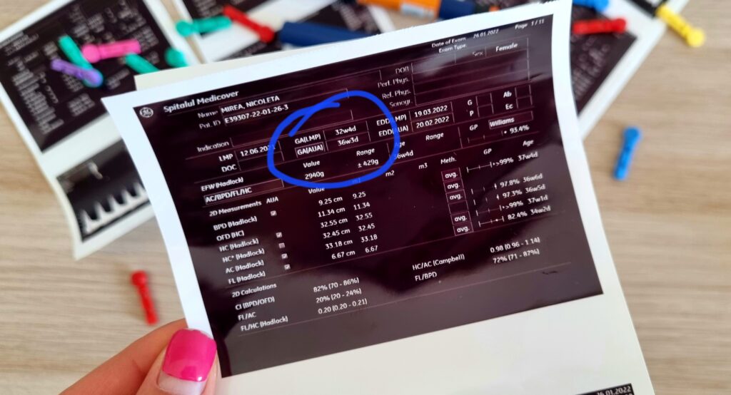 Sarcina cu diabet gestational