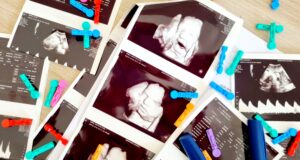 SARCINA – TRIMESTRUL 3 – COMPLICAȚIILE DIABETULUI GESTAȚIONAL