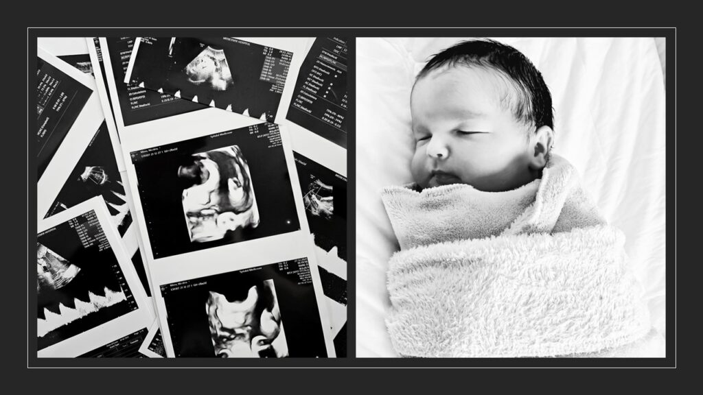 Before and after naștere